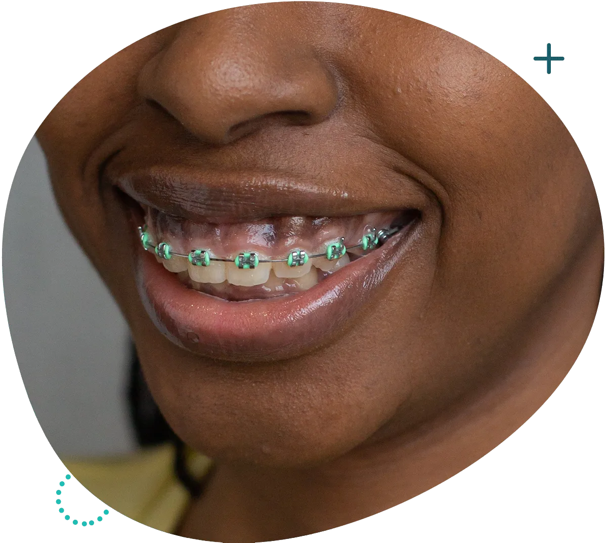 https://studionaturaldental.it/wp-content/uploads/2023/10/home-service-1.webp