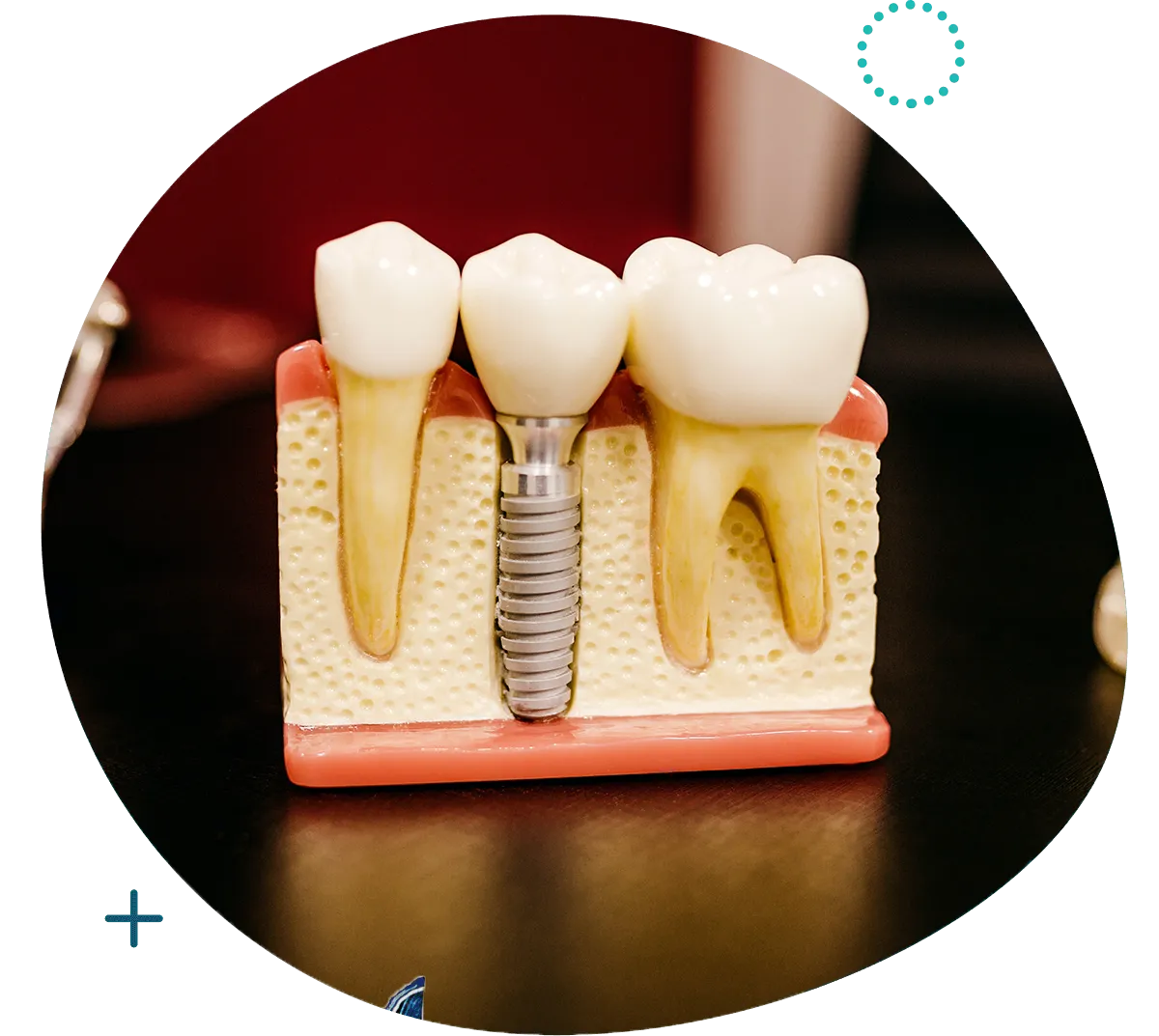 https://studionaturaldental.it/wp-content/uploads/2023/10/home-service-3.webp