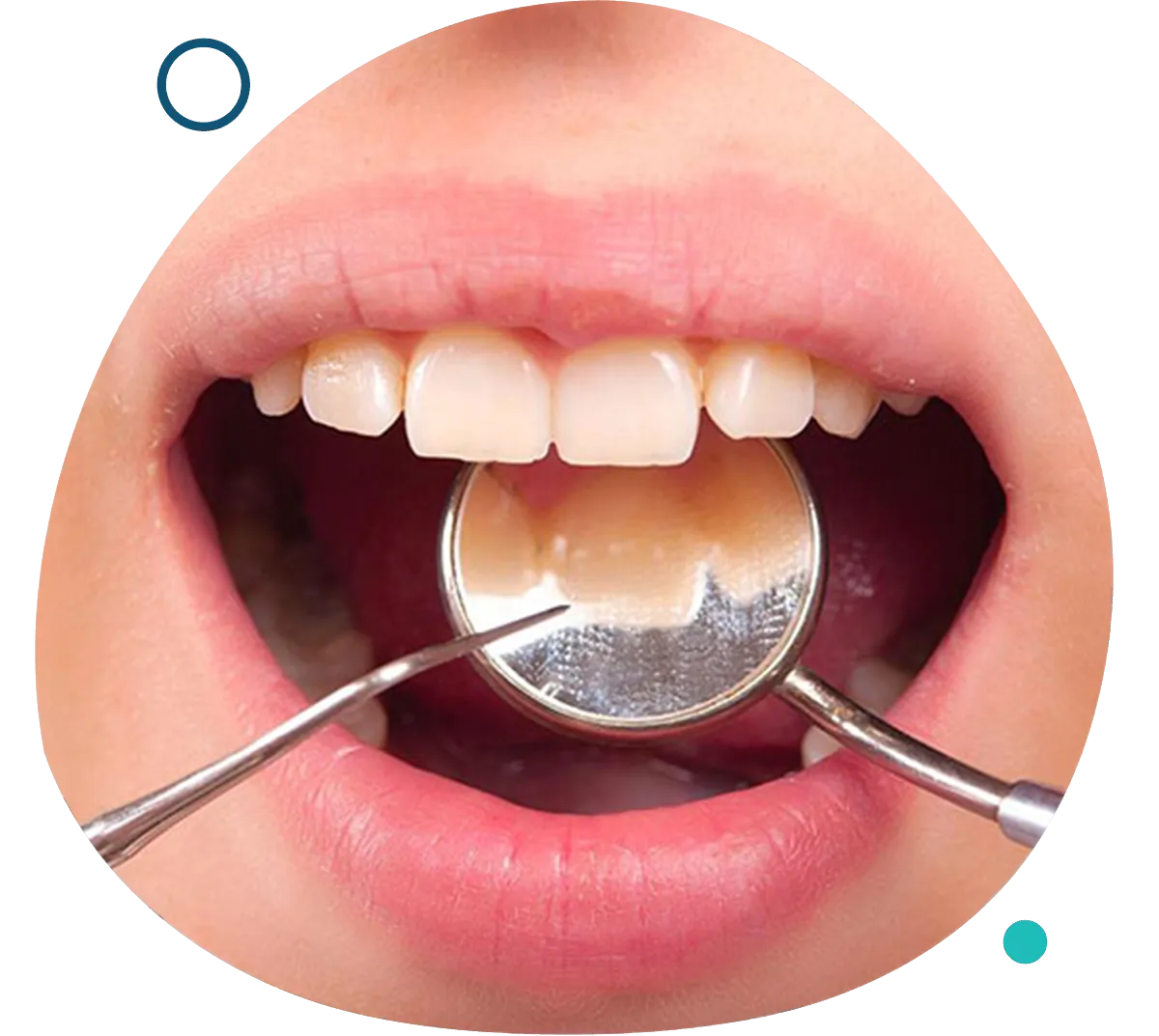 https://studionaturaldental.it/wp-content/uploads/2023/10/home-service-4.webp